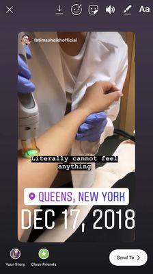 Candela GentleMaxPro laser for high performance treatment and a painless effective one !