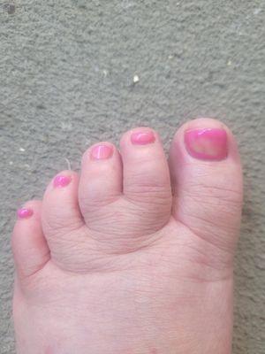 Polish coming off on day 2.