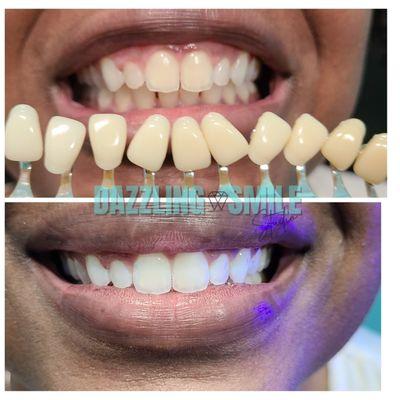 Dazzling Smile Express