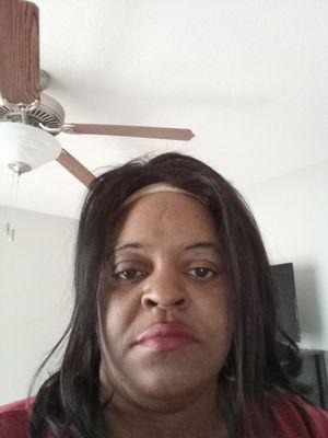 A woman with shcizophrenia