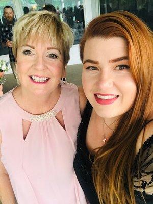 Dr. Cameron brightened and improved my smile before my nephew's wedding.  Thrilled