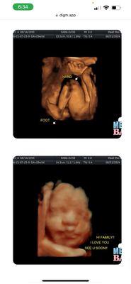 Meet the Baby Ultrasound