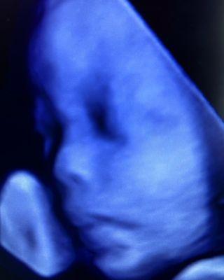 3D profile image in color. It's a boy