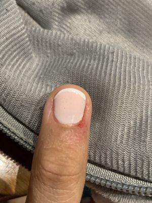 One of her cuticles was over trimmed. The stinging stays until it heals. Takes away from a perfect first time manicure.