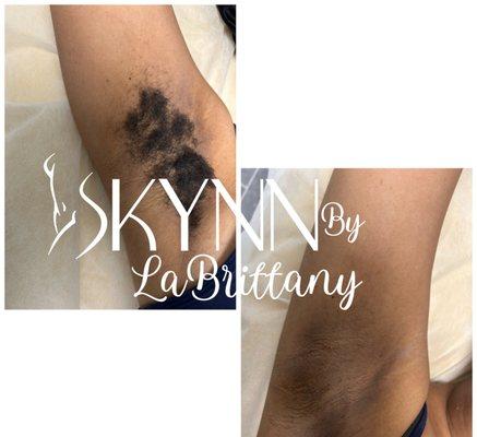 Skynn By LaBrittany