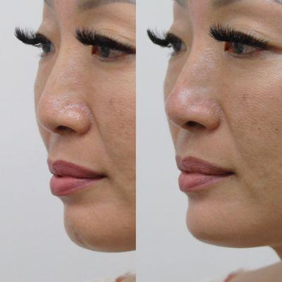 Melanie Tantisira MD LLC