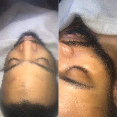 Cbd facial