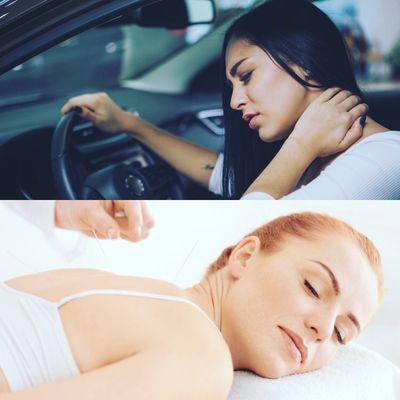 Acupuncture & Injury