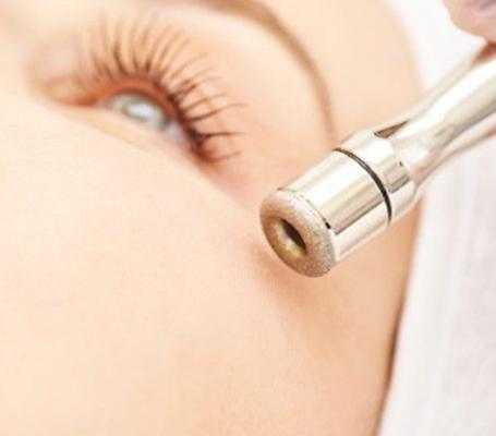 Microdermabrasion And Full Facial