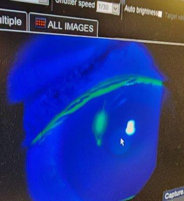 Fremont Optometric Vision Care Center