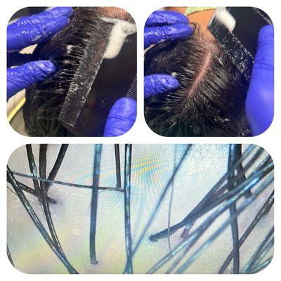 Scalp cleansing during head spa