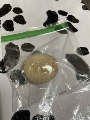 The bladder stone they removed.