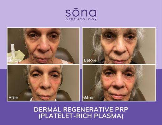 Sona Dermatology of Greensboro