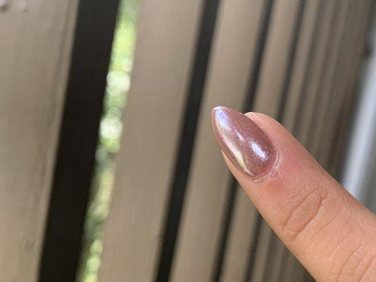 Finger swollen, red and painful to touch.