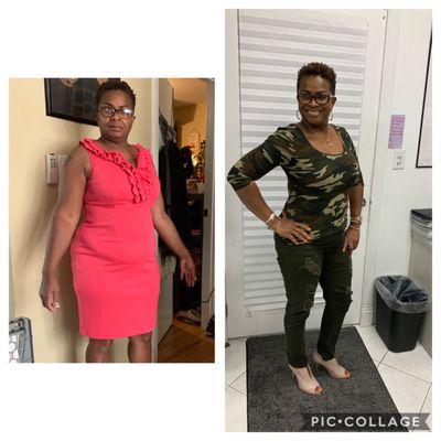 My before and after photo