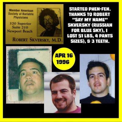 I didn't lose any teeth (that's a meth joke) but I did lose 51 lbs