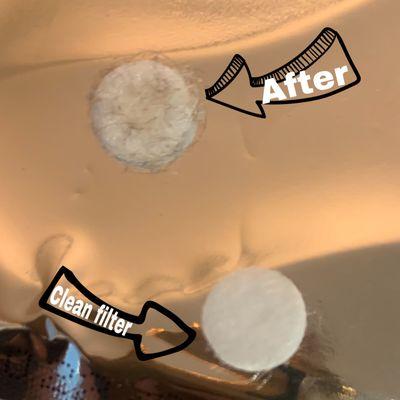 Filter before and after a microdermabrasion treatment