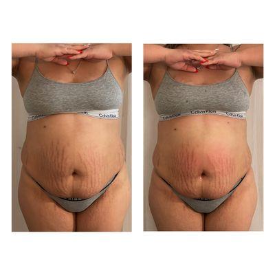 Figure 8 Body Contour