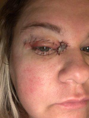 The graph I received after reconstruction.