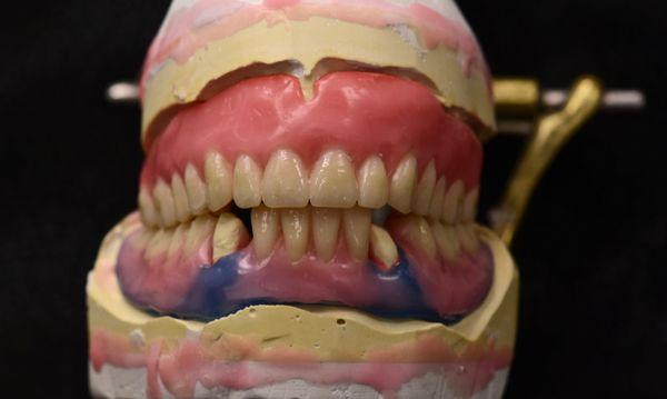 Chain O'lakes Dental Lab