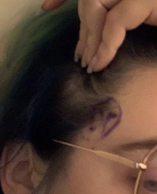 Carolina Neurosurgery & Spine Associates PA