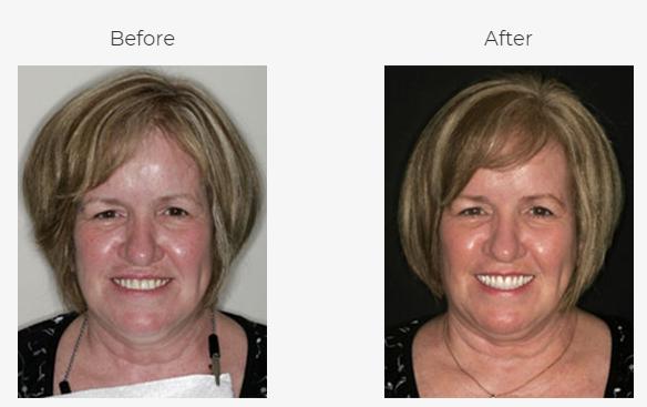 Dental Excellence of Blue Bell