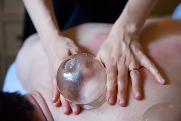 Massage Cupping