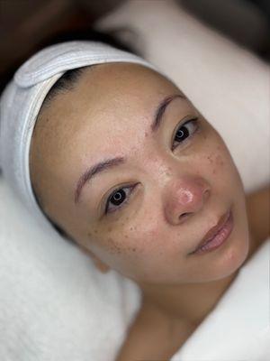 Glow's Signature glass skin facial