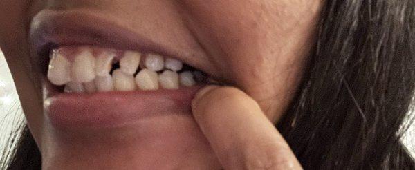 I paid money for it to not look like this for after it to look like this can't make this up.