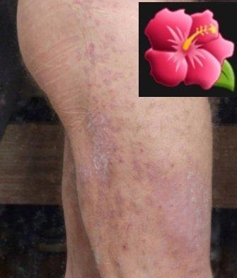 Christopher D Koenig, MD