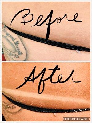 Aviva Labs Gimme Brown 10% DHA before and after