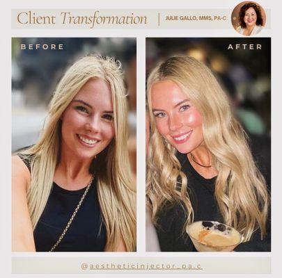 Aesthetic Philosophy