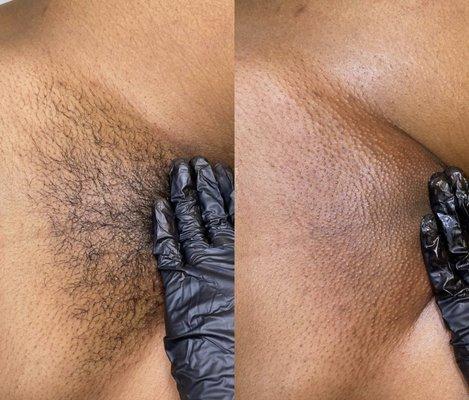 Brazilian Wax