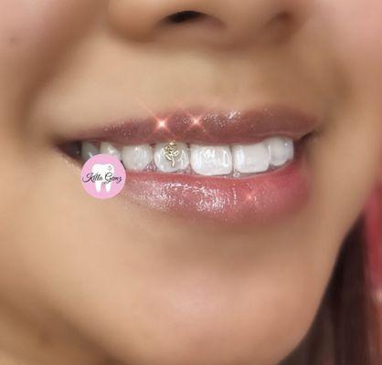18kt tooth jewelry, retention rate 6-12+ months.