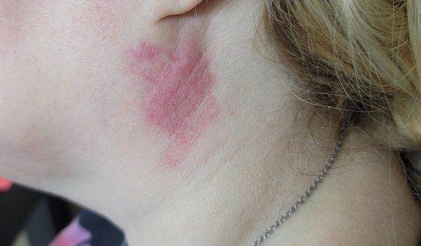 Affordable Dentures & Implants