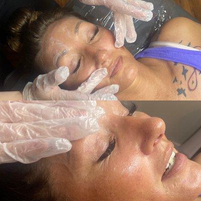 Procell Therapies Microchanneling