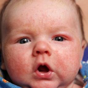 Herbal Doctor Remedies