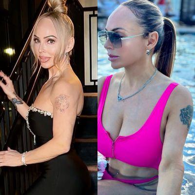 The left photo is the result after 6 sessions.