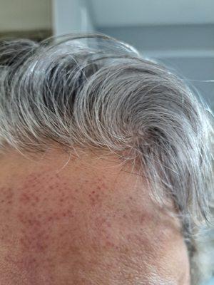 Skin Tight MedSpa Acton