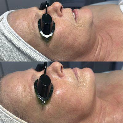 From dry aging skin to hydrated glowing skin with less visible signs of aging