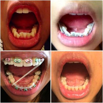 Stewart Carina Gacusan DDS Family Dentistry