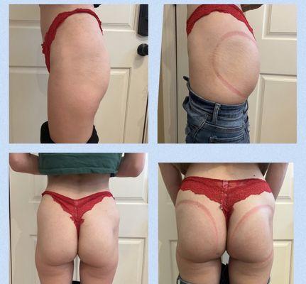 Shape it Up Contouring