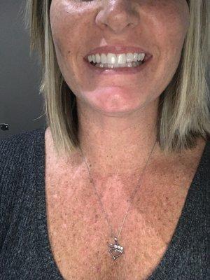 Hirezi Family Dentistry