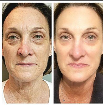 Autumn's Facial and Waxing Studio