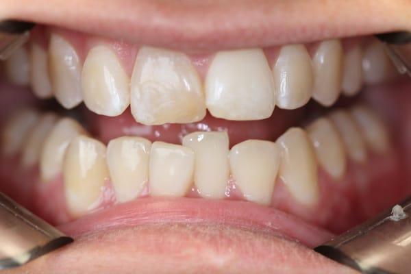 Hughes Family Dental