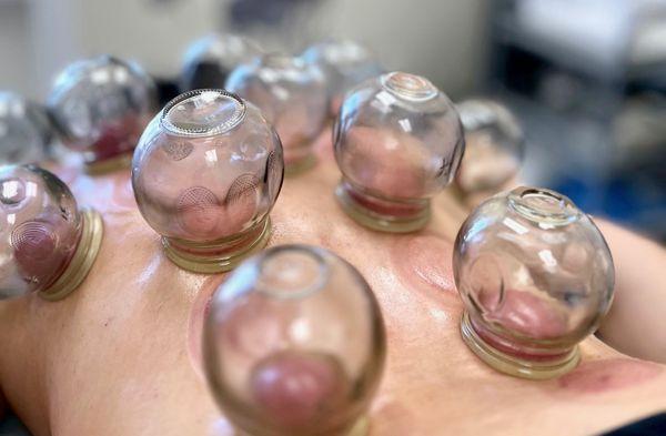 Kapok TCM Acupuncture