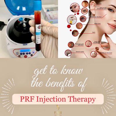 PRF Platelet-Rich Fibrin