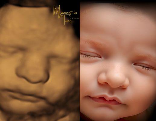 3D to 8K Enhancement