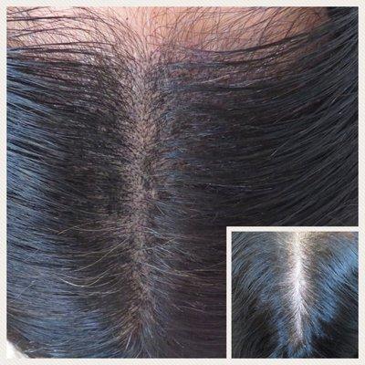 Female Scalp MicroPigmentation before and after, first session, immediate results, replicating hair follicles, add density, thick hair