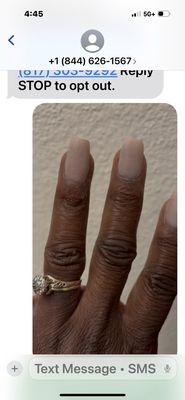 This the botched job by the trainee.